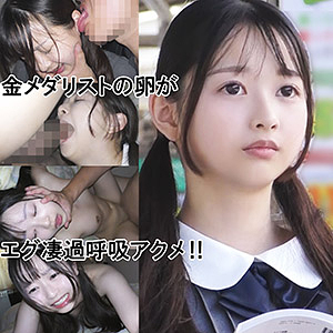IBちゃん(仮名)【ゆず故障】 望月つぼみ